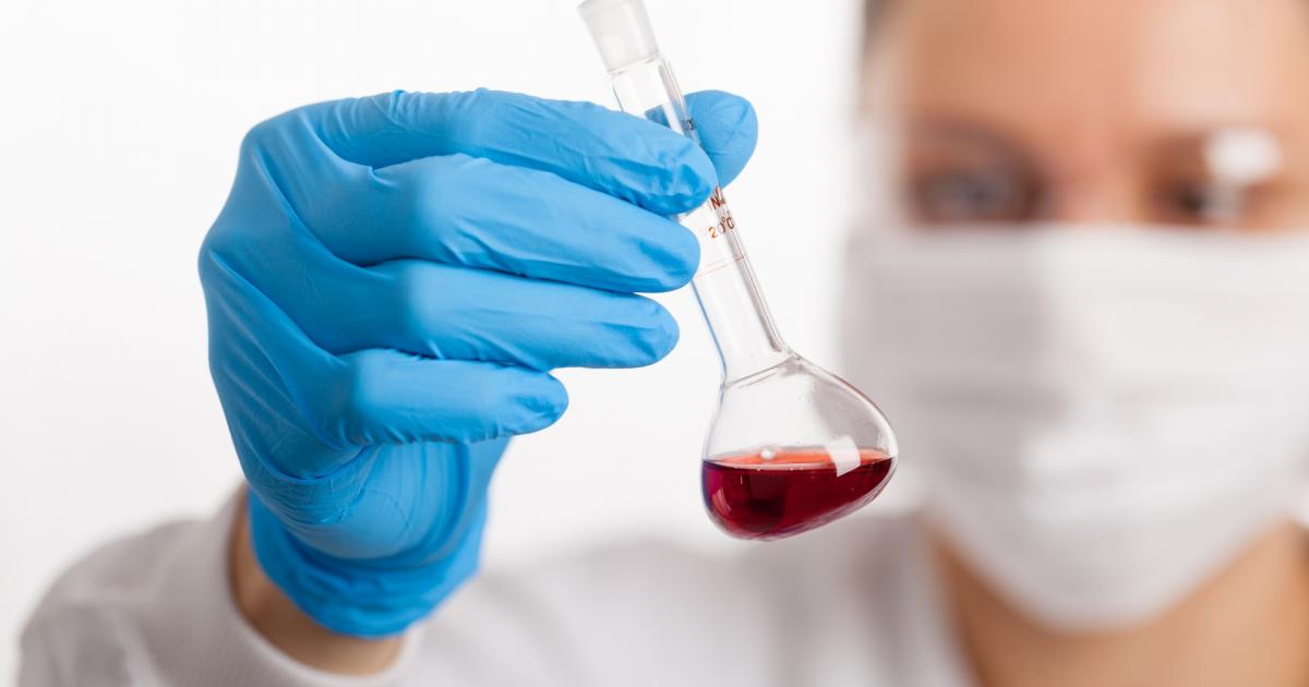 Point Covid : l’épidémie ne décroît toujours pas
