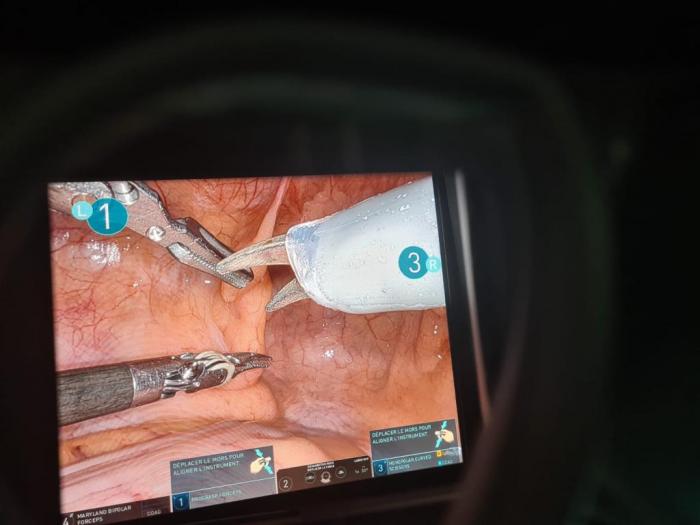 prostate opération 