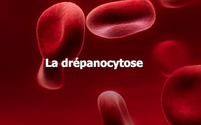 Drépanocytose : des patients dénoncent la mauvaise prise en charge