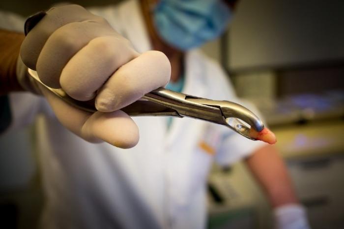 Les chirurgiens dentistes en colère