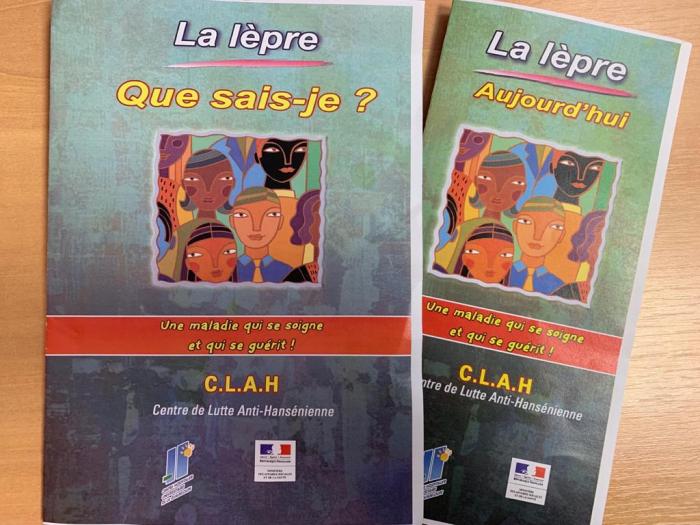 Lèpre en Guadeloupe: entre 1 et 4 cas traités chaque année