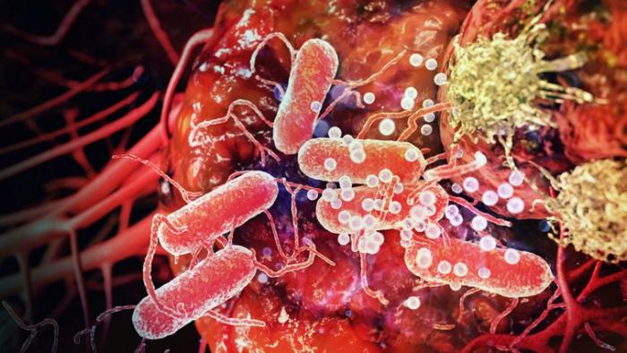 Où traiter son cancer en Martinique ?