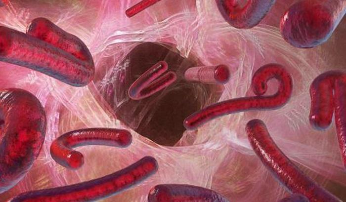 Préparer les Antilles à une éventuelle arrivée d'Ebola