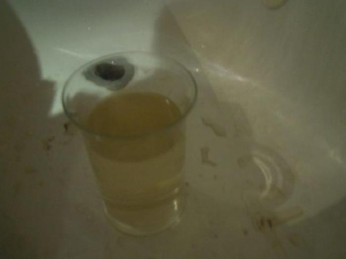 Quand l'eau sera de retour dans vos robinets, des précautions à prendre