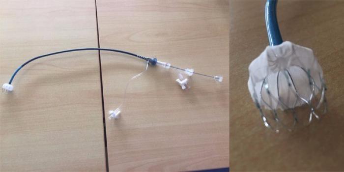 Une nouvelle technique pour lutter contre les d’Accidents Vasculaires Cérébraux
