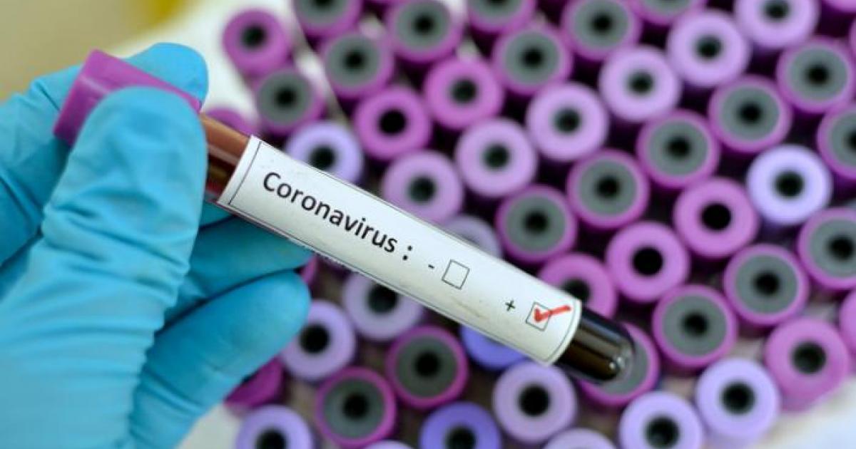     





COVID-19 : 7 nouveaux cas confirmés




