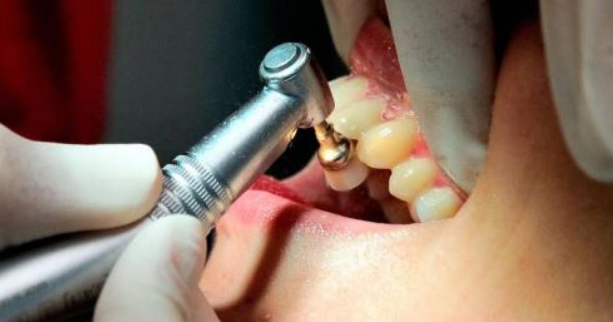     





Les dentistes se préparent à la sortie du confinement




