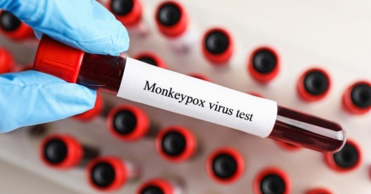 Variole du singe : l’Organisation Mondiale de la Santé appelle à une surveillance accrue